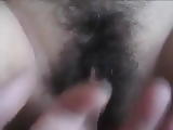 Mbbg 